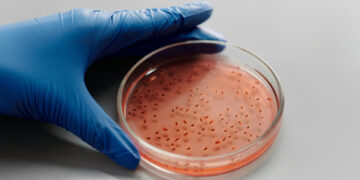 Descoberta de 45 novas toxinas da salmonella nunca vistas que podem revolucionar antibióticos