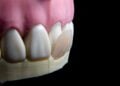 Adesivo pode fazer dentes nascerem novamente e promete aposentar dentaduras