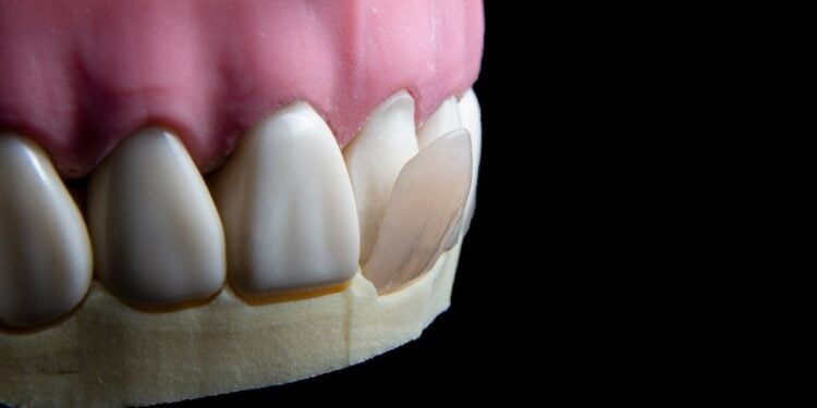 Adesivo pode fazer dentes nascerem novamente e promete aposentar dentaduras