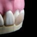 Adesivo pode fazer dentes nascerem novamente e promete aposentar dentaduras