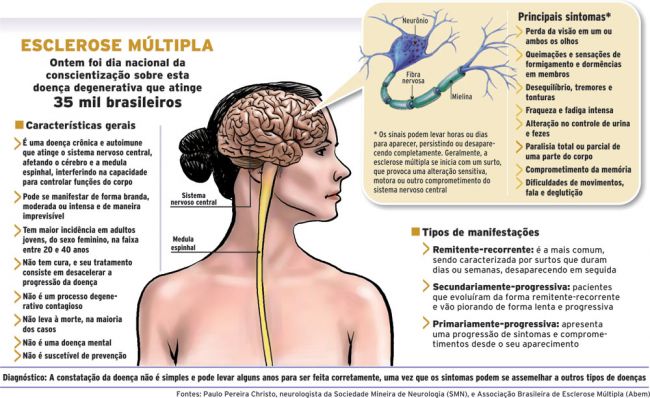 Vida prática - Esclerose múltipla