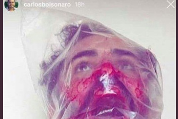 carlos bolsonaro insta capa