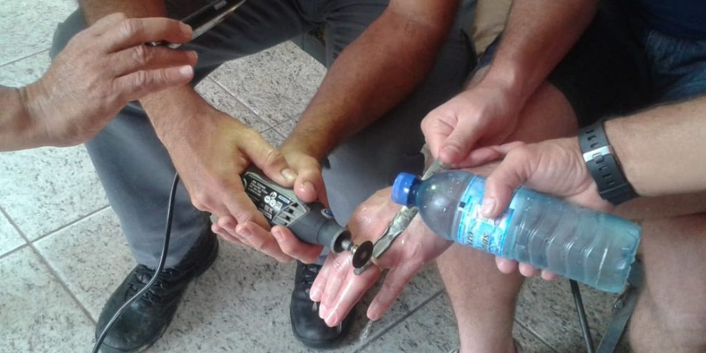 Homem prende anel em dedo e precisa de ajuda dos Bombeiros 2 para capa dedo preso divulgação bombeiros