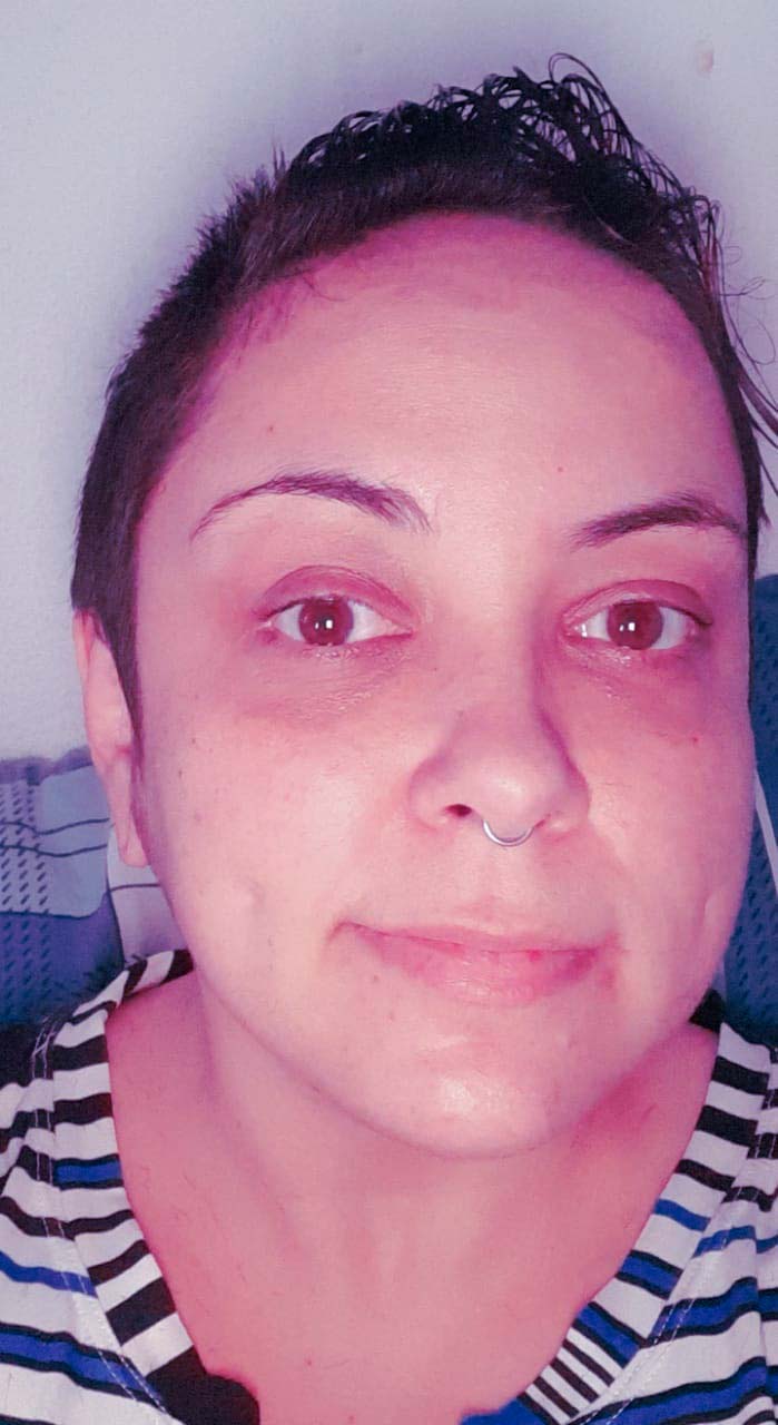 2 Daiane paciente câncer de mama