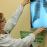 tuberculose fotografo bye agencia brasil