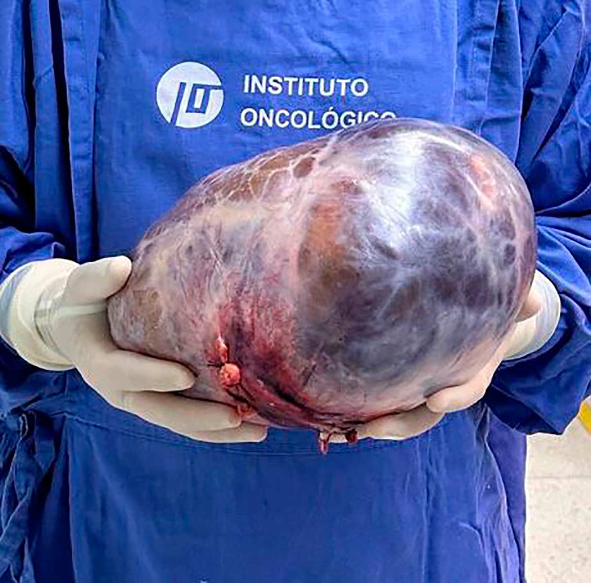 tumor 5kg foto arquivo pessoal 2