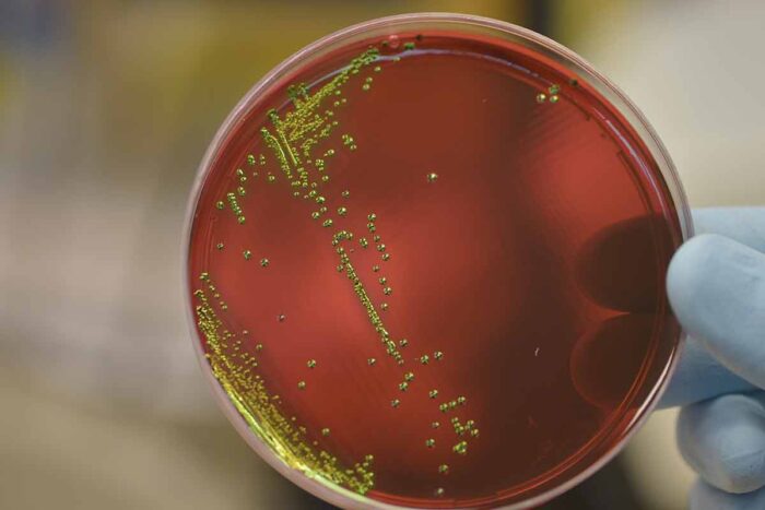 superbacterias by Gutemberg Brito IOC Fiocruz