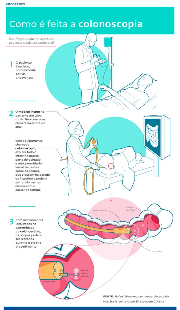 einstein INFO colonoscopiav2