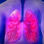 heparina tratamento inflamacao pulmonar imagem kalhh Pixabay