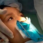 labio leporino cirurgia reconstrutiva foto reproducao tv brasil