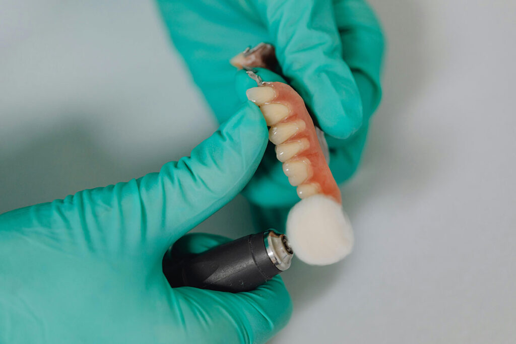 Transplante dentario Pexels