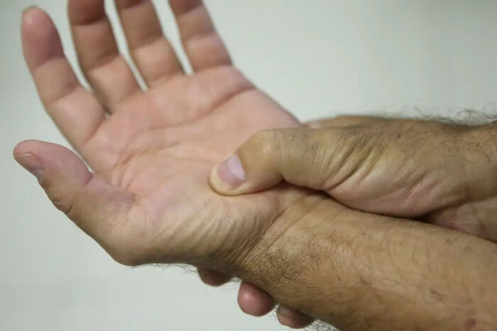 fibromialgia
