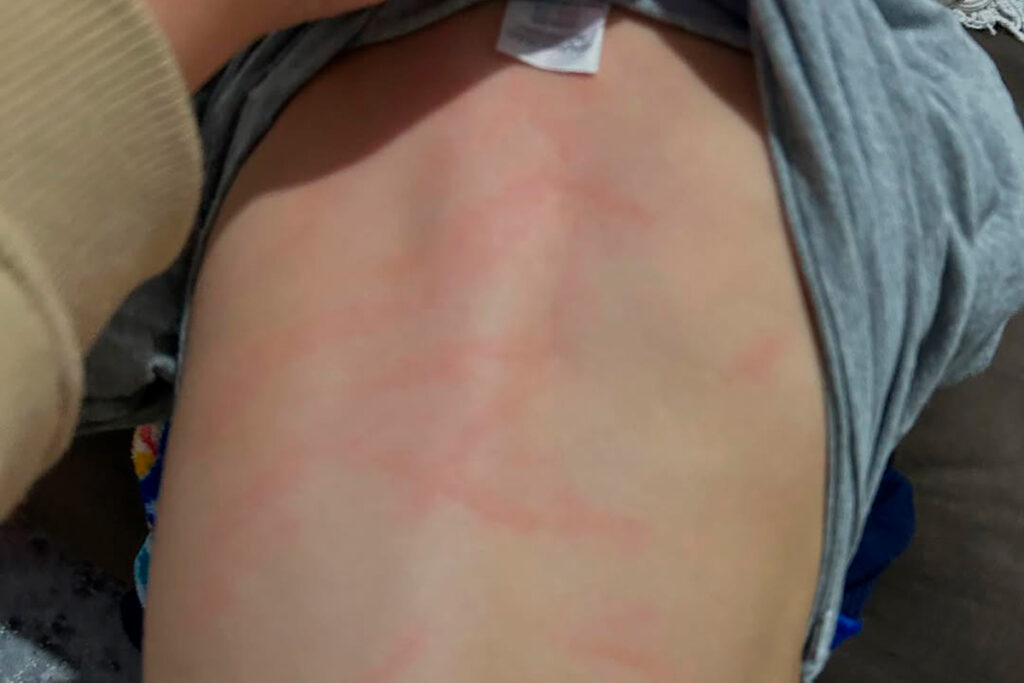Denúncia de agressão a criança em creche de Juiz de Fora: envolvidos serão ouvidos nesta quinta-feira pela Polícia