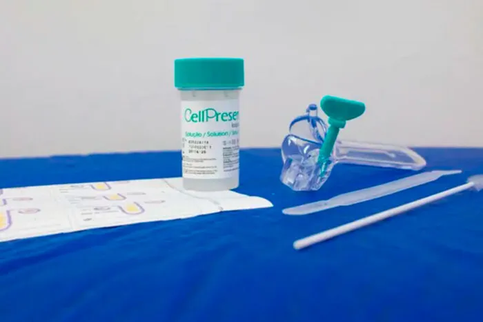 Juiz de Fora recebe kits para implantação de exame que vai substituir Papanicolau no SUS 1 novo exame sus agencia brasil