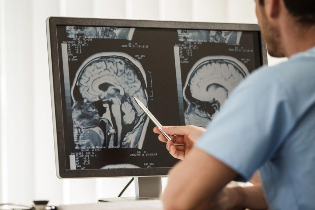 Vorasidenibe: entenda as promessas do medicamento recém-aprovado para câncer cerebral
