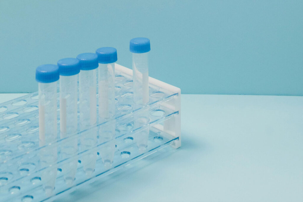 Diagnóstico do câncer de próstata avança com novas técnicas e uso mais eficiente do PSA 1 exame psa cancer deprostata pexels
