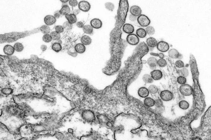 hantavirus CDC Cynthia Goldsmith reproducao