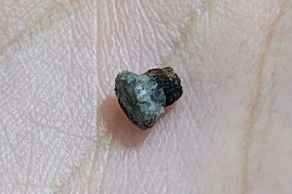 Cliente é indenizado após achar parafuso em comida de restaurante muito famoso