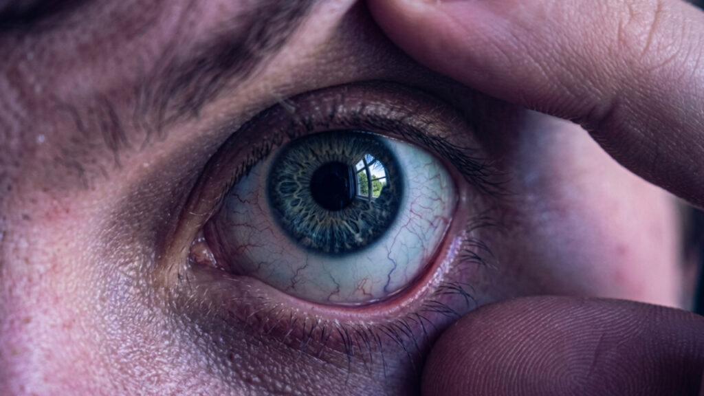 Sinal nos olhos que a maioria das pessoas ignora pode aparecer dias antes de um AVC