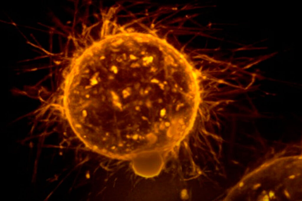 Cientistas brasileiros identificam proteína que pode ajudar a conter progressão do câncer 1 estudo cancer foto NCI Unsplash