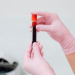Exame de sangue conhecido como 'biópsia líquida' ajuda a identificar 4 vezes mais casos de câncer, diz estudo 21 exame de sangue biopsia liquida foto pexels