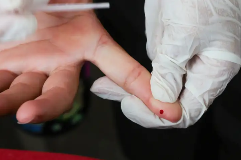Juiz de Fora tem Dia D com testes rápidos e gratuitos para hepatites, sífilis e HIV 1 teste rapido hepatite