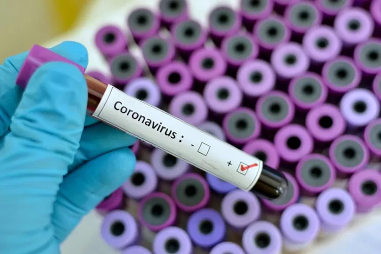 coronavirus by federacaors.org .br