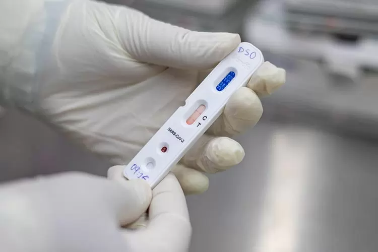 teste coronavirus covid by Jose Wagner saude ceara