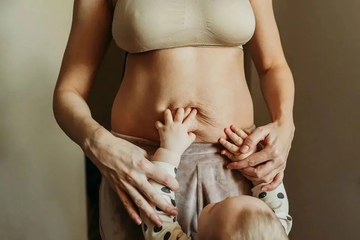 Até um terço das mulheres pode enfrentar complicações a médio e longo prazo após o parto 1 Até um terço das mulheres pode enfrentar complicações a médio e longo prazo após o parto