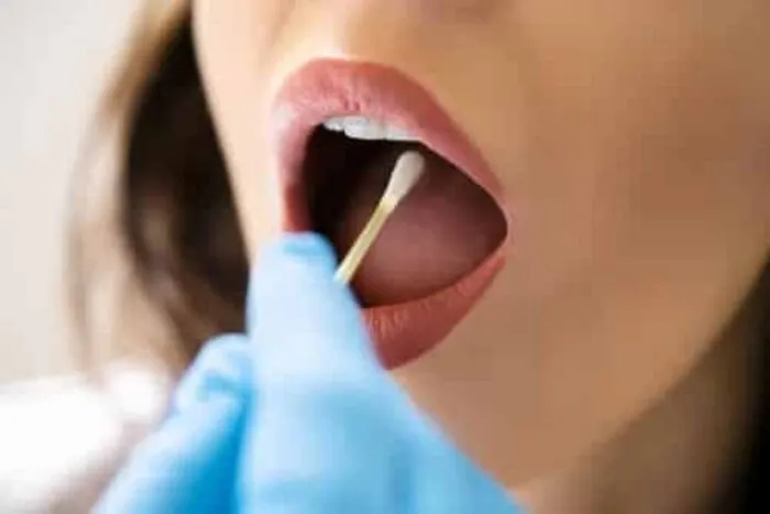 Bactéria da boca pode estar associada ao câncer colorretal 1 boca